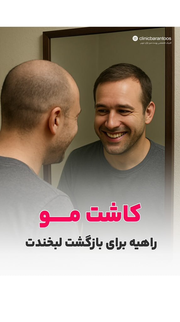 تأثیر مو بر اعتماد به نفس و ضرورت کاشت مو